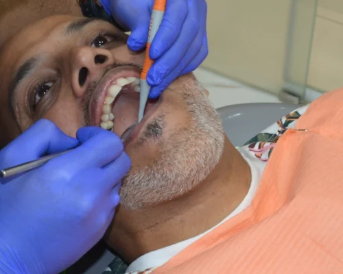 dental-restoration dental-restoration